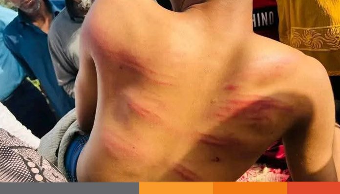 ঝিনাইদহে ইফতারের ফল খাওয়ায় মাদরাসার ছাত্রকে নির্যাতন