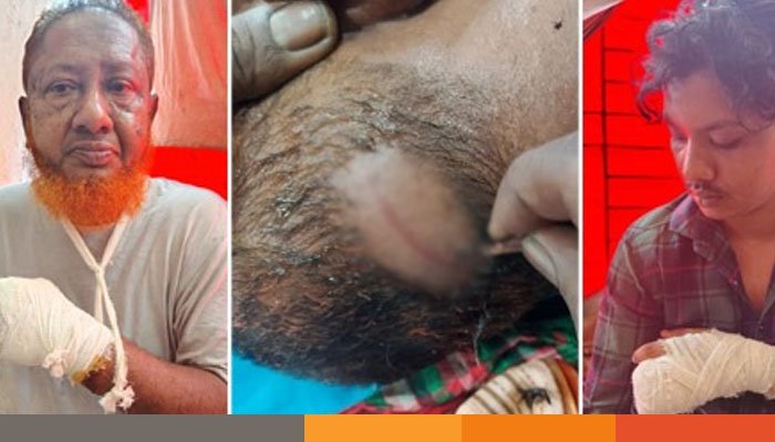 নোয়াখালীতে প্রতিপক্ষের হামলায় নারীসহ আহত ৩ নোয়াখালীতে প্রতিপক্ষের হামলায় নারীসহ আহত ৩