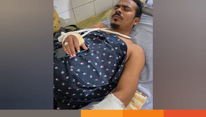 সরাইলে ডাকাতি ঠেকাতে উদ্যোগ নেওয়ায় ব্যবসায়ীর উপর হামলা