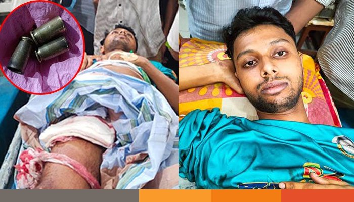 খুলনায় দুর্বৃত্তের গুলিতে বিশ্ববিদ্যালয়ের ছাত্র আহত