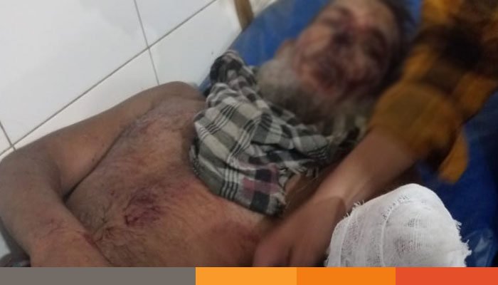 ব্রাহ্মণবাড়িয়ায় দুইপক্ষের সংঘর্ষে বৃদ্ধের হাতের কবজি বিচ্ছিন্ন ব্রাহ্মণবাড়িয়ায় দুইপক্ষের সংঘর্ষে বৃদ্ধের হাতের কবজি বিচ্ছিন্ন