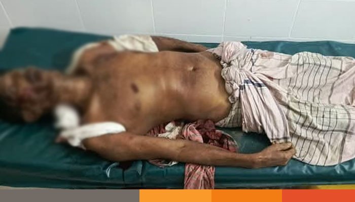 বেনাপোলে ঈদ ময়দানে সন্ত্রাসী হামলায় বিএনপি কর্মী নিহত