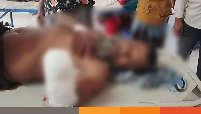 ব্রাহ্মণবাড়িয়ায় সম্পত্তি নিয়ে বিরোধে চাচার হাতের কবজি কেটে বিচ্ছিন্ন করলো ভাতিজা