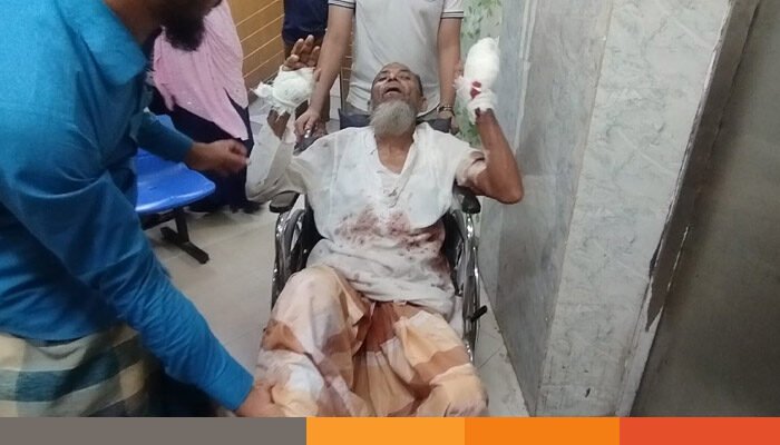 বাড়ি দখল করতে বাবার হাত-পা ভেঙে রগ কেটে দিলো ছেলে